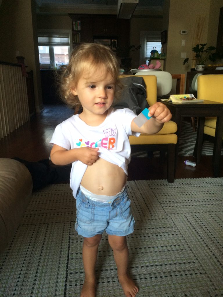child with pacemaker